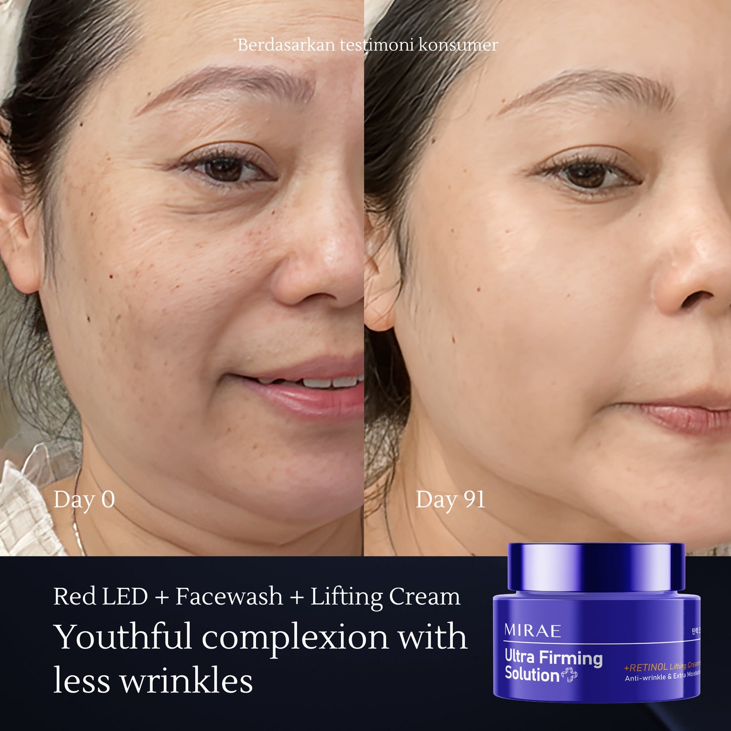 Ultra Firming Solution Retinol Lifting Cream 50ml | Anti Wrinkle & Extra Moisturize | Treat Wrinkles & Moisturize Skin