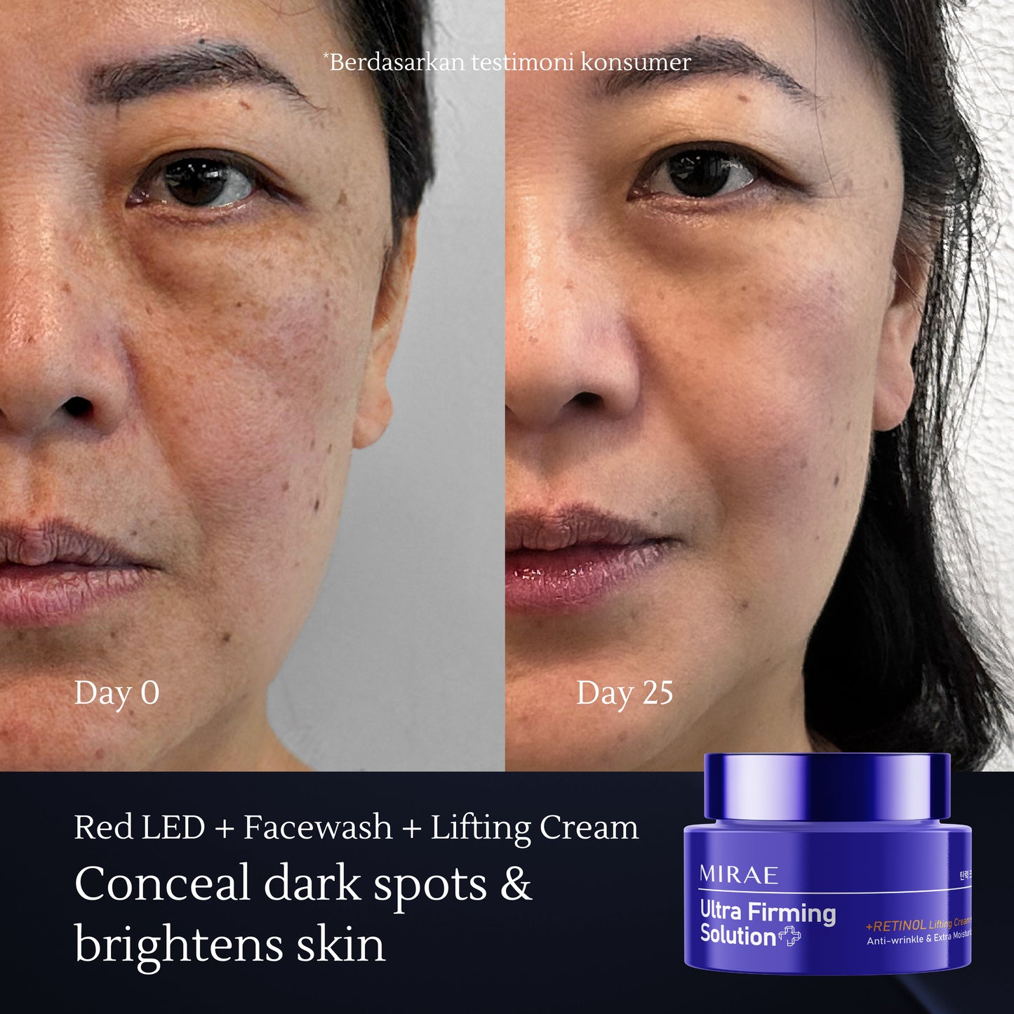 Ultra Firming Solution Retinol Lifting Cream 50ml | Anti Wrinkle & Extra Moisturize | Treat Wrinkles & Moisturize Skin