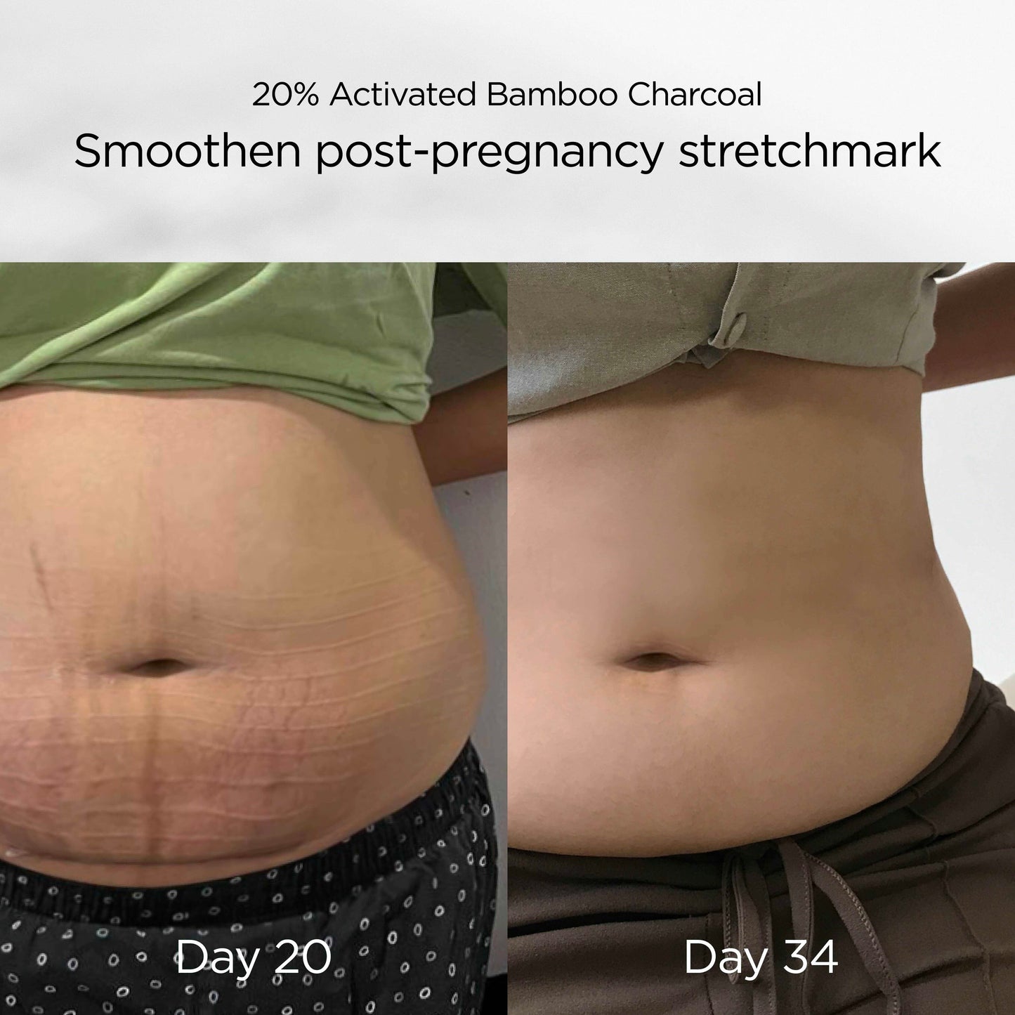 Nano Bamboo Postnatal Recovery & Support Belly Band (S-M) | Postnatal Slimming Corset | FAST SLIM Antibacterial & Safe for Caesar Nano Bamboo