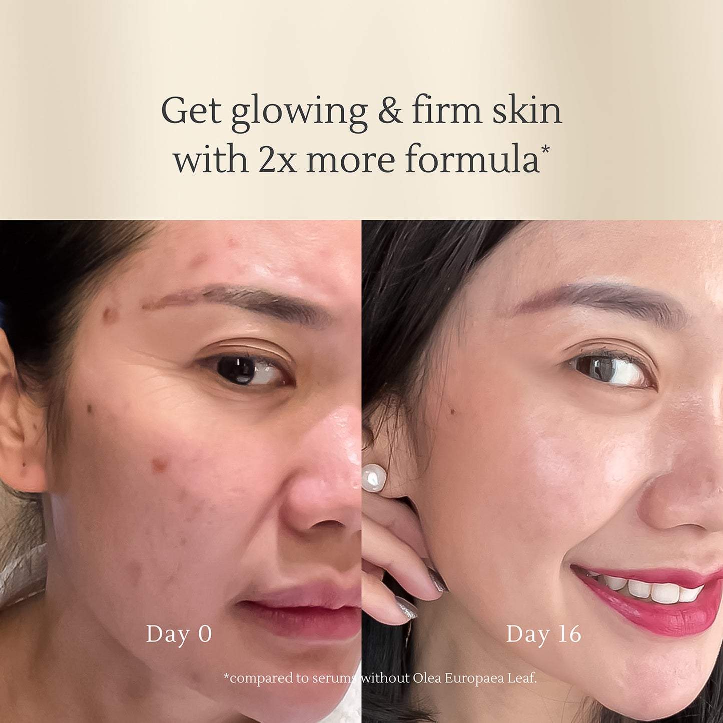 Micrite 3D All Use Skin Serum Acne Scars Fade in 7 Days | Repair Skin Barrier | Brighten dull skin, dry/combination skin, remove small acne or hormonal acne, disguise spots/melasma